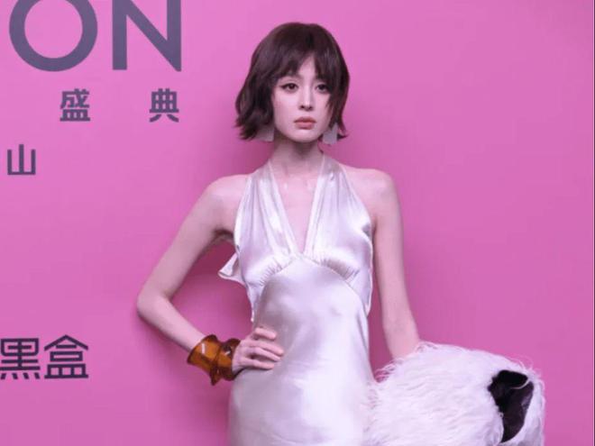 颜值下降不是一点点没有以前气场了人生就是搏娜扎新鲜照片瘦成竹竿